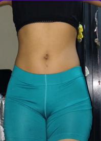 Antes de entrenar con Luis Felipe Toro Silva, transformación 3